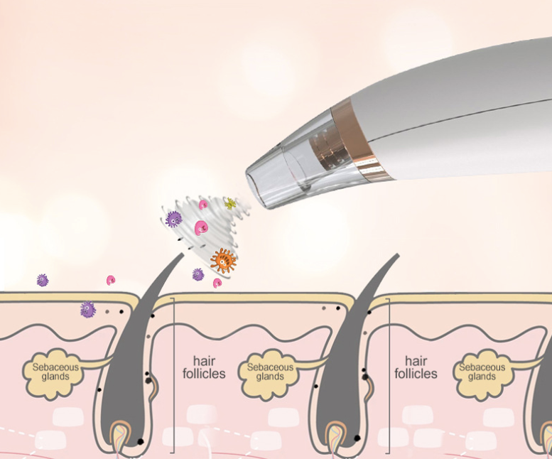 Powerful Electric Blackhead Remover for Home Use
