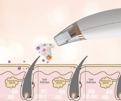 Powerful Electric Blackhead Remover for Home Use